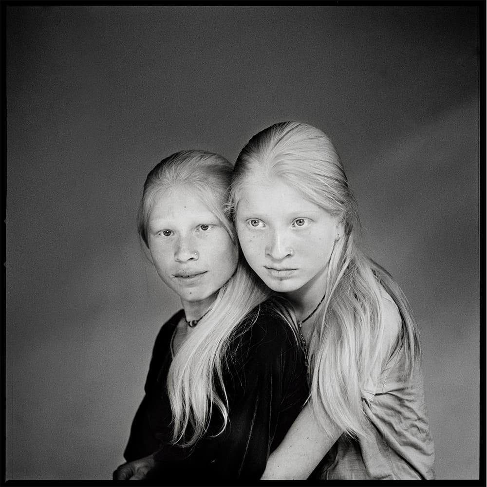 Sangita and Laxmi, best friends with albinism, in Nepal.