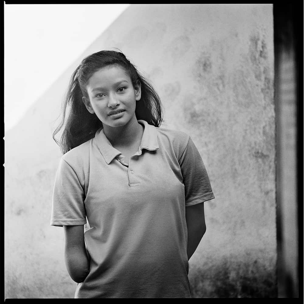 Sabita, who lost her hands in an accident, strives to help others