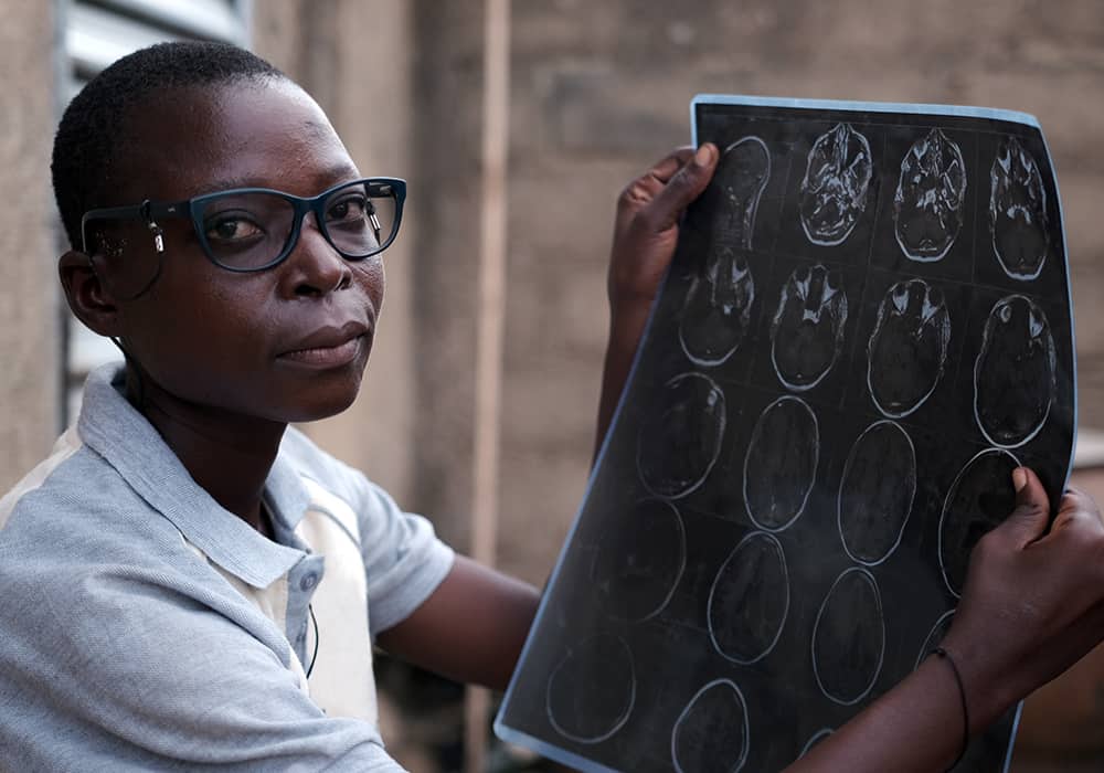 Valentine holds an x-ray that shows scans of her brain activity and how her brain is affected by her disability. 